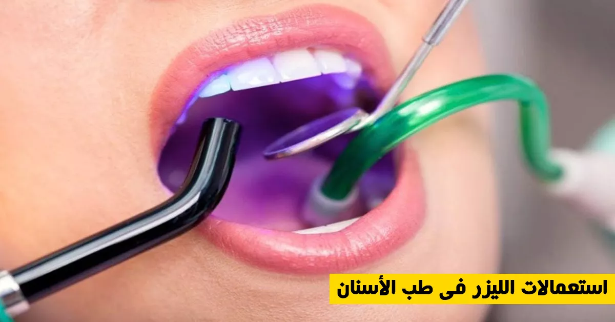 استعمالات الليزر في طب الأسنان